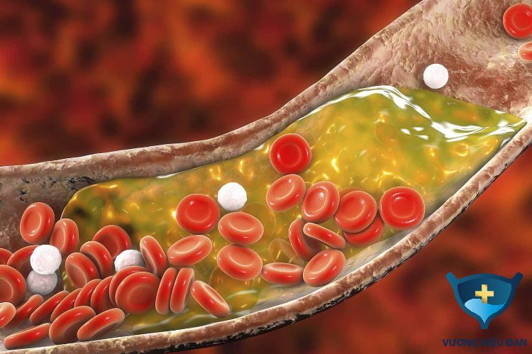 Hạt bí ngô giúp làm giảm lượng cholesterol ở trong máu